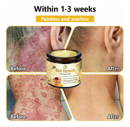Revitaliza Tu Piel Con Crema de Abeja